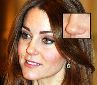 kate-middleton-nose-.jpg